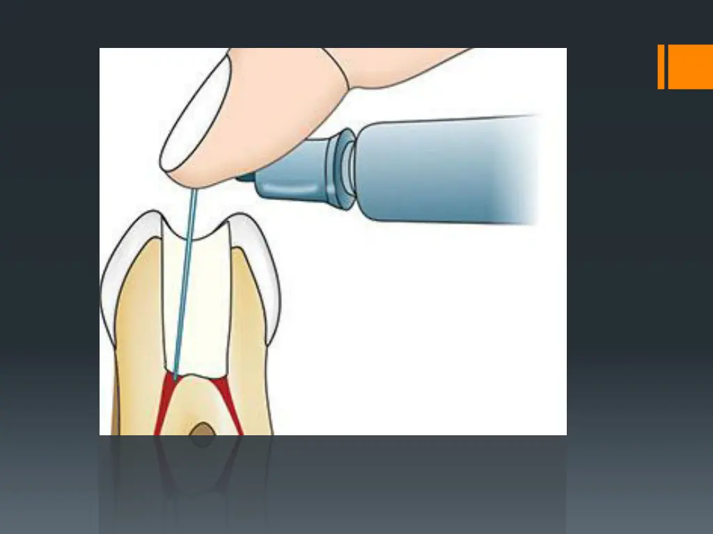 slide45