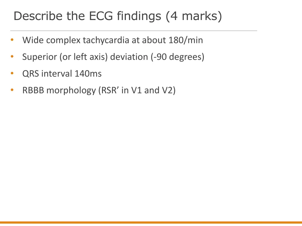 describe the ecg findings 4 marks