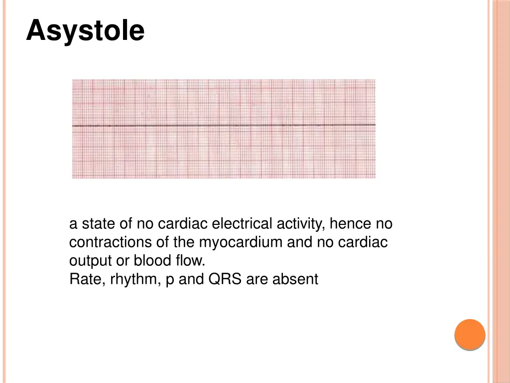 asystole