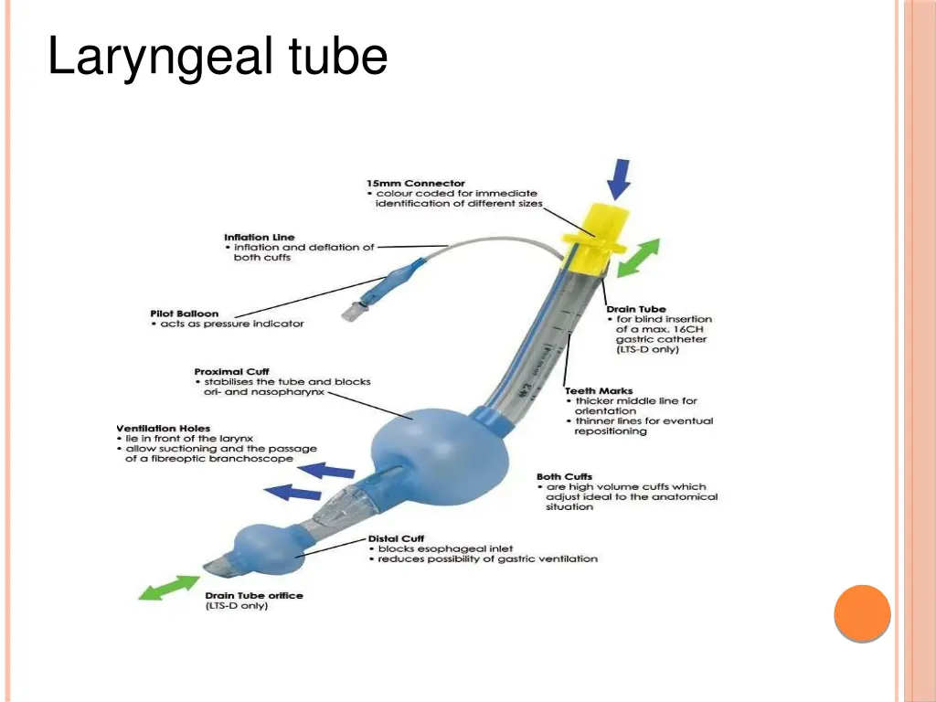 laryngeal tube