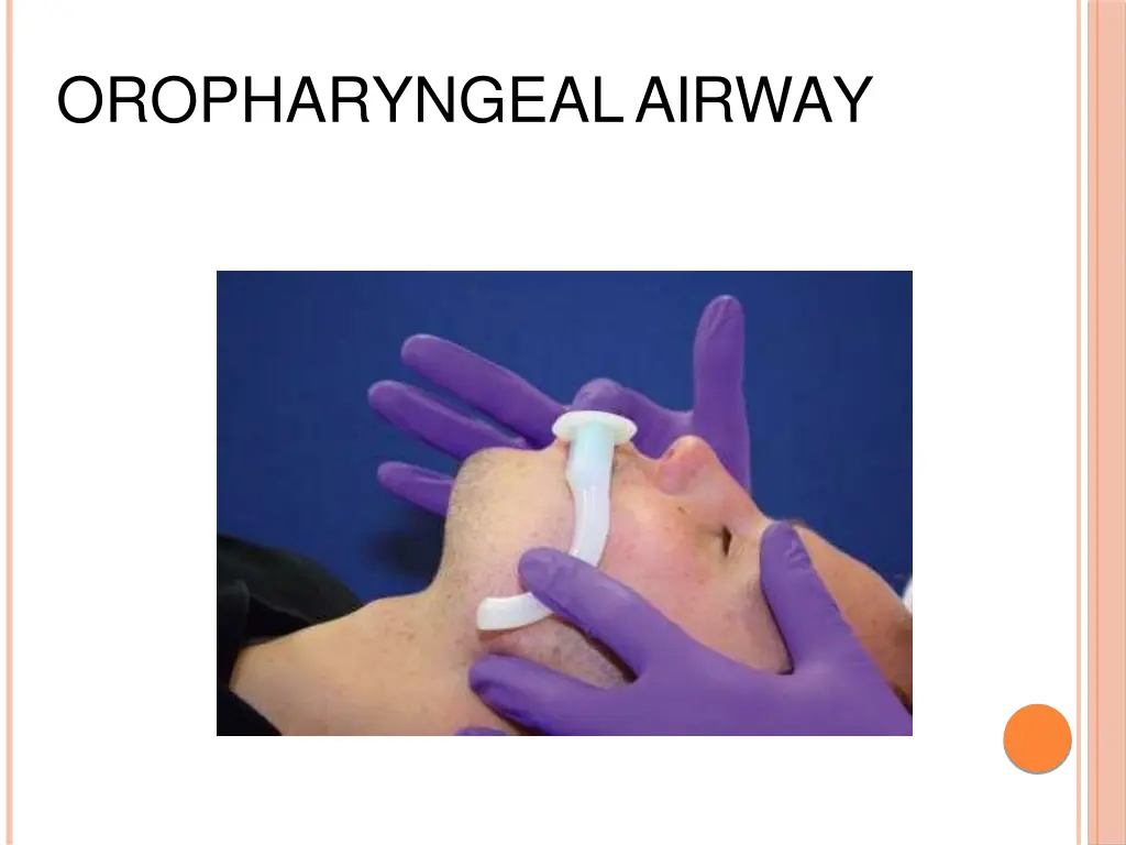 oropharyngealairway