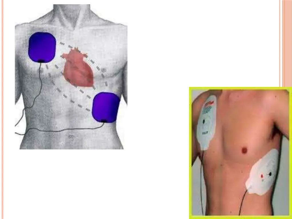 slide35