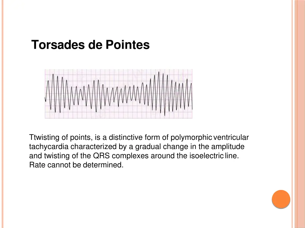 torsades de pointes