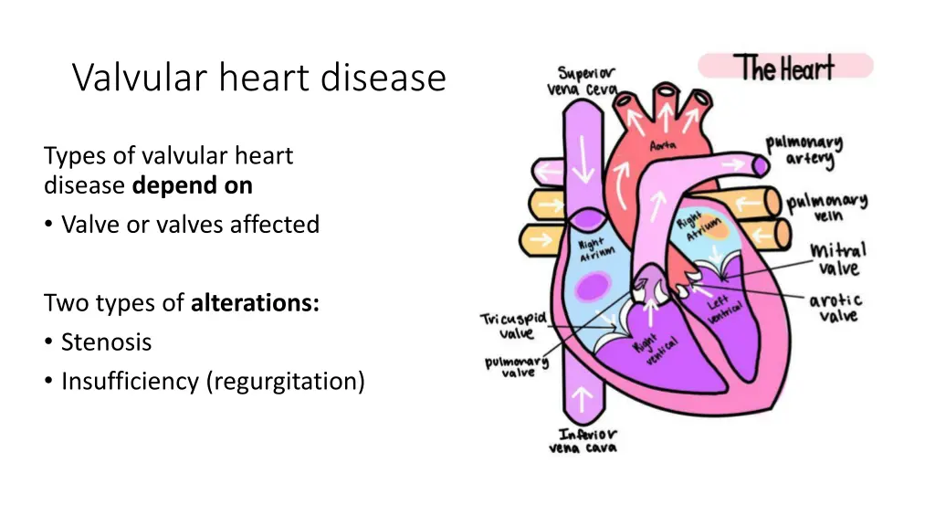valvular heart disease