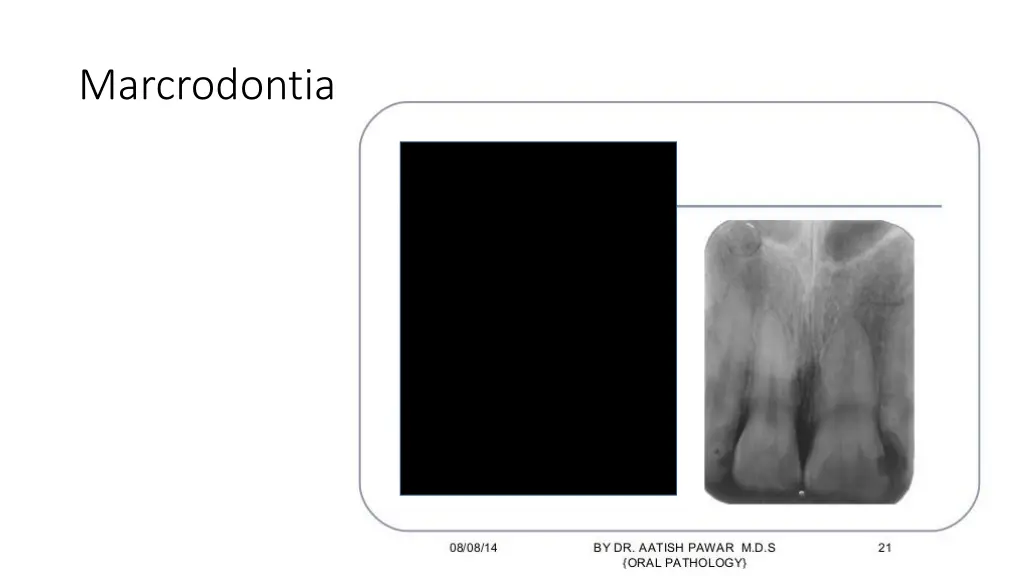 marcrodontia