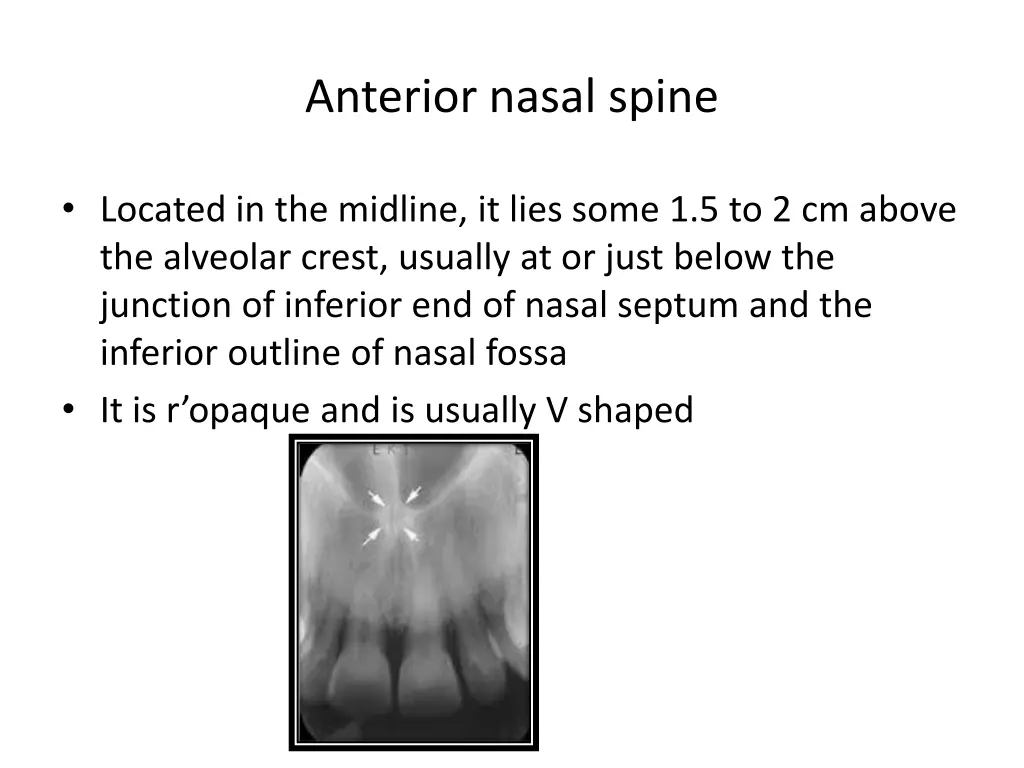 anterior nasal spine