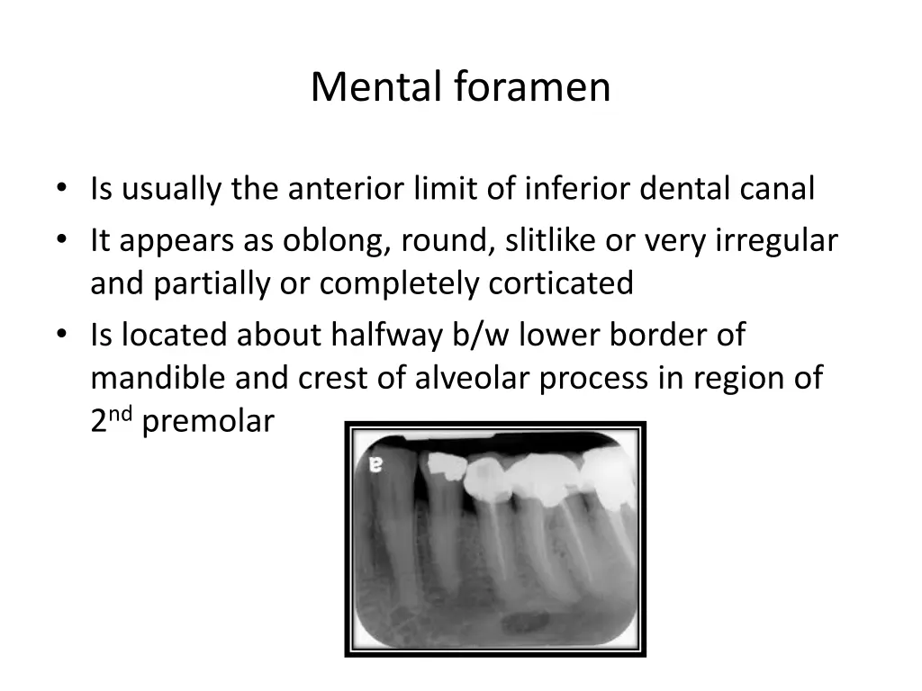 mental foramen