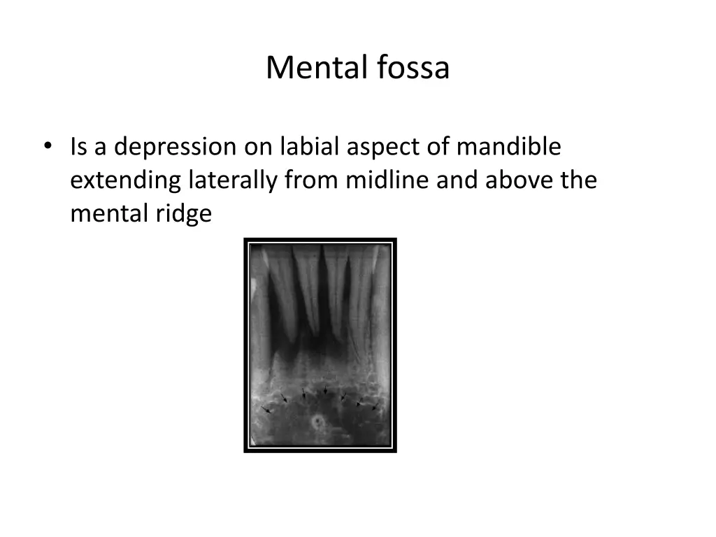 mental fossa