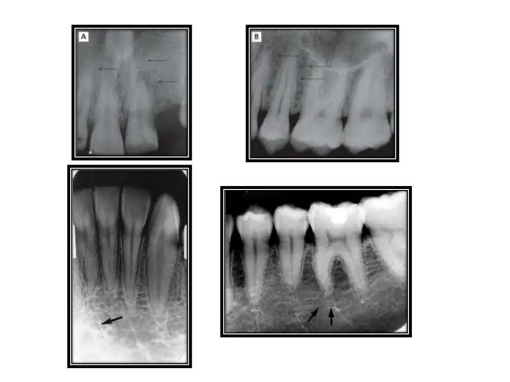 slide11