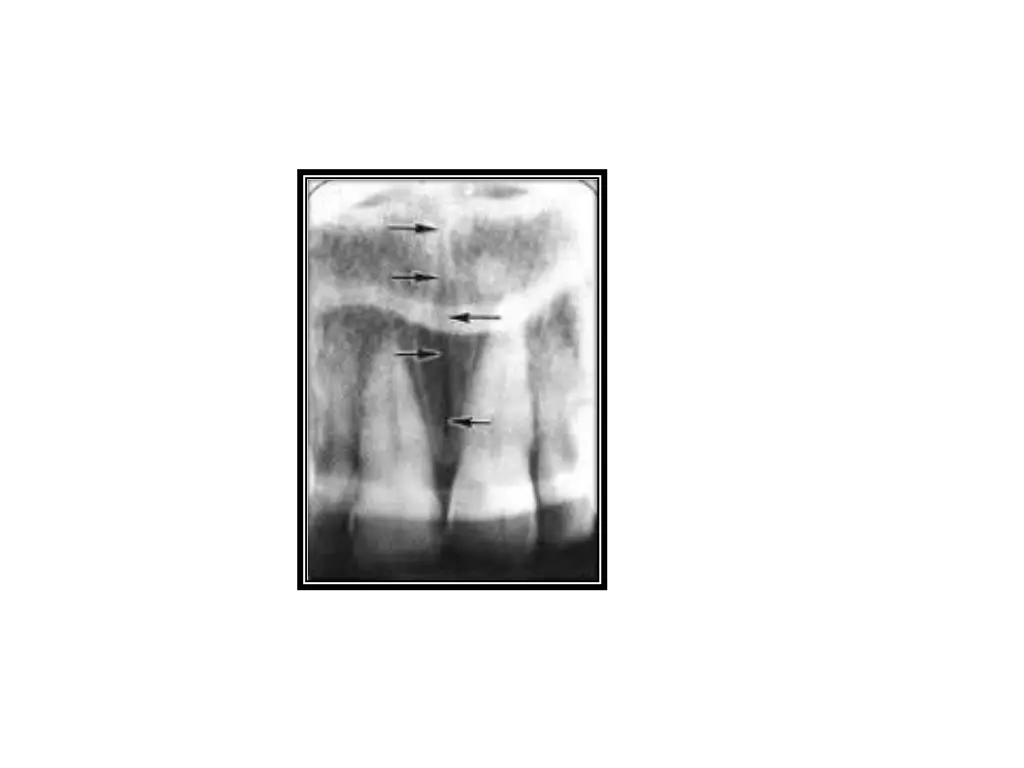 slide14