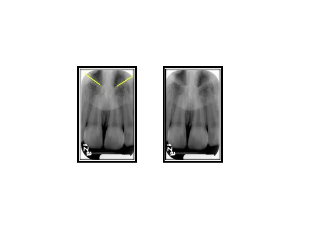 slide17