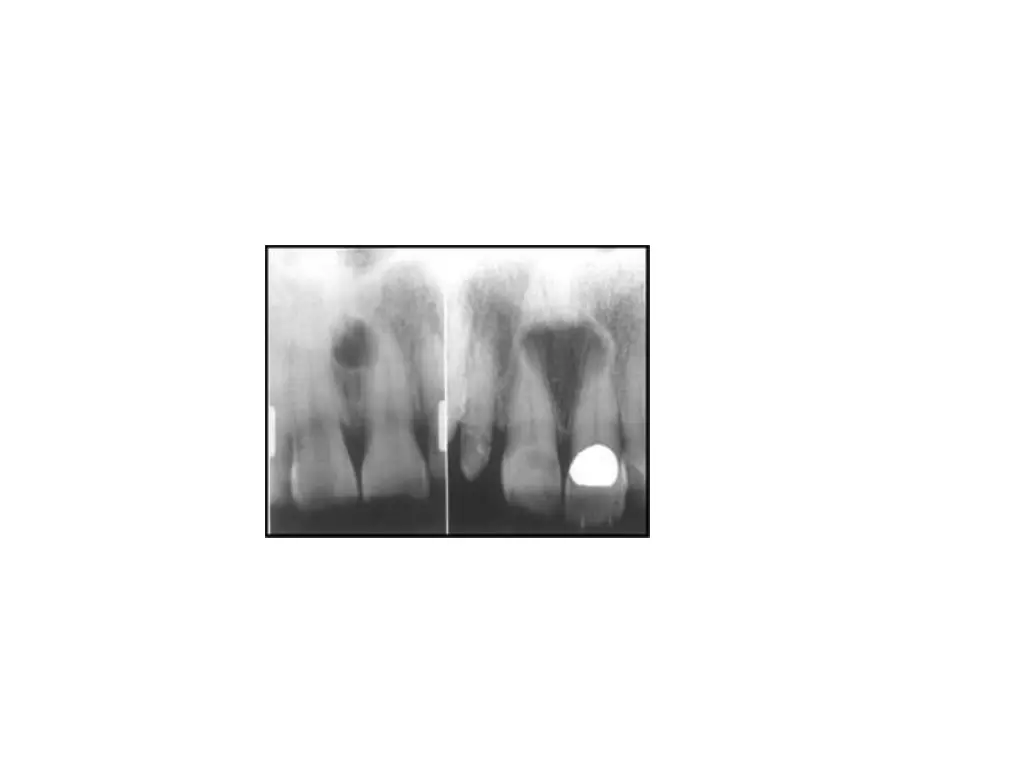 slide19