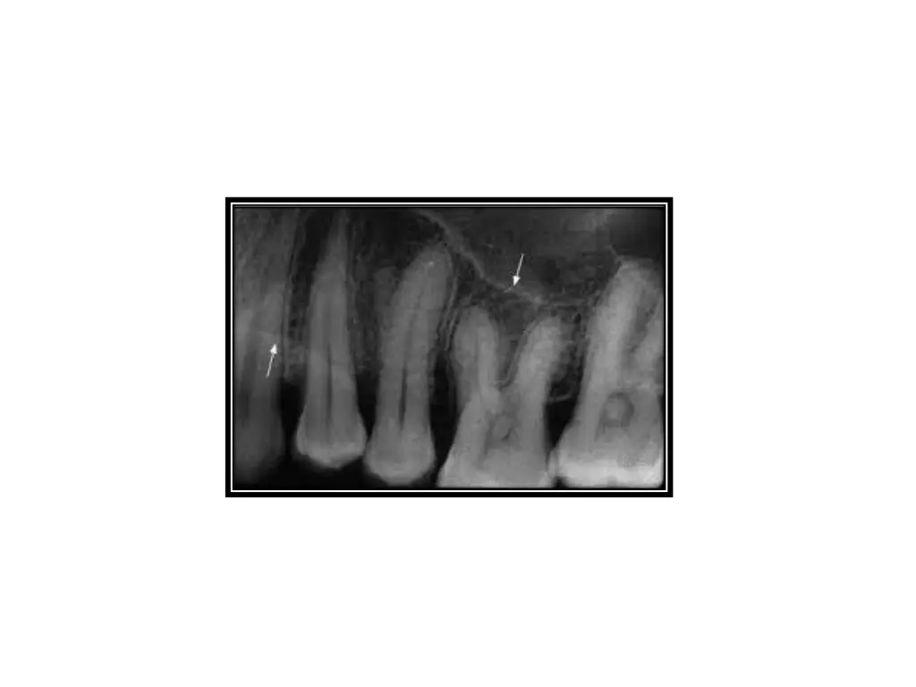 slide2