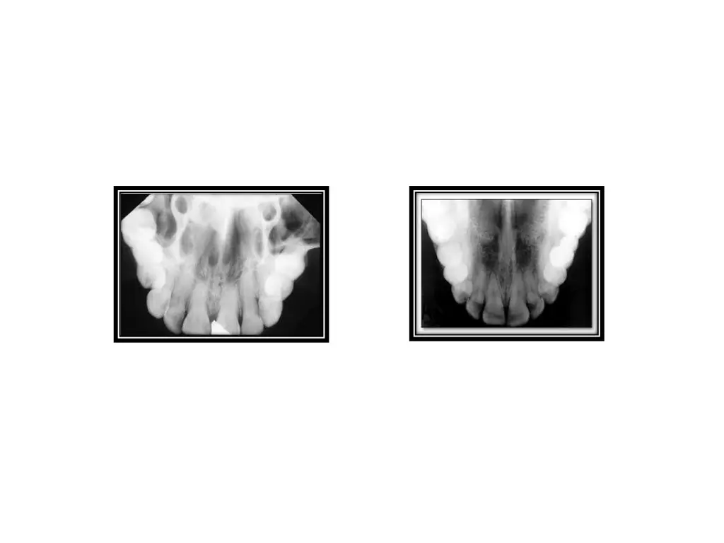 slide21