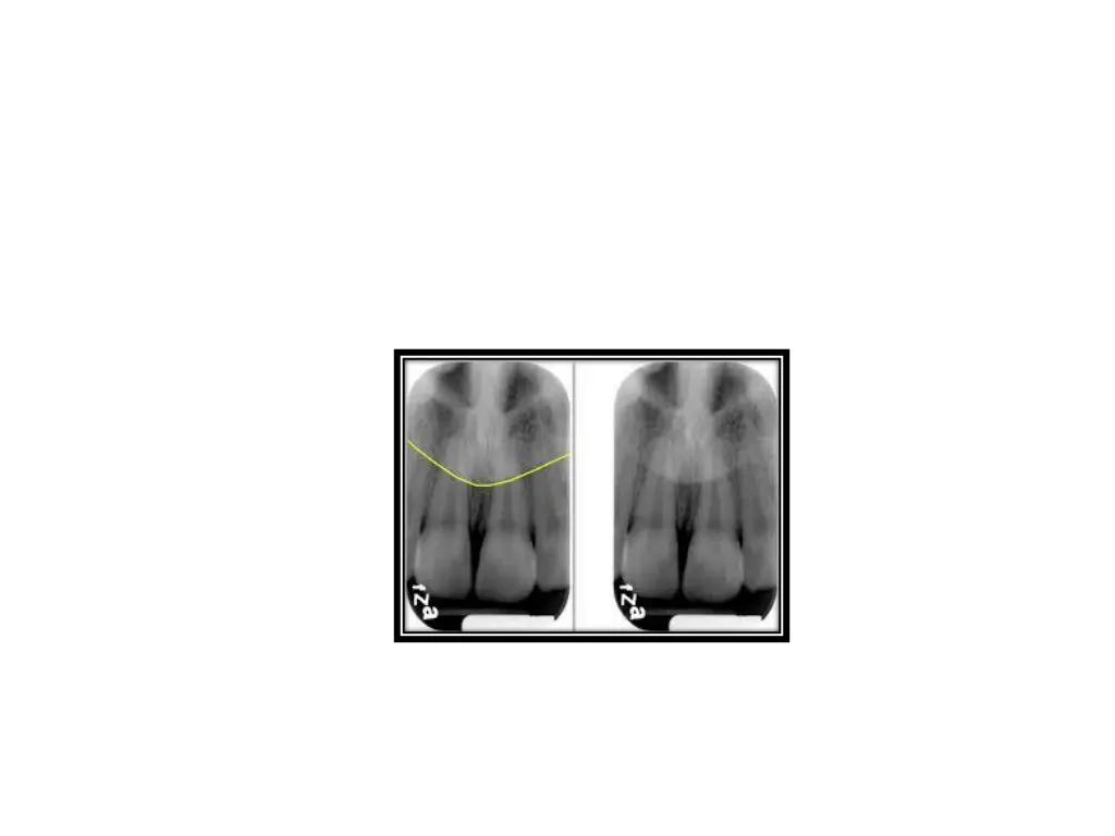 slide25