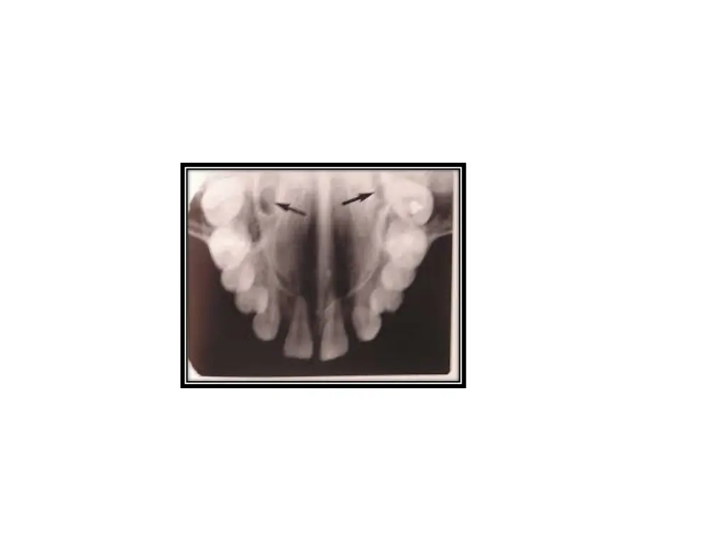 slide27