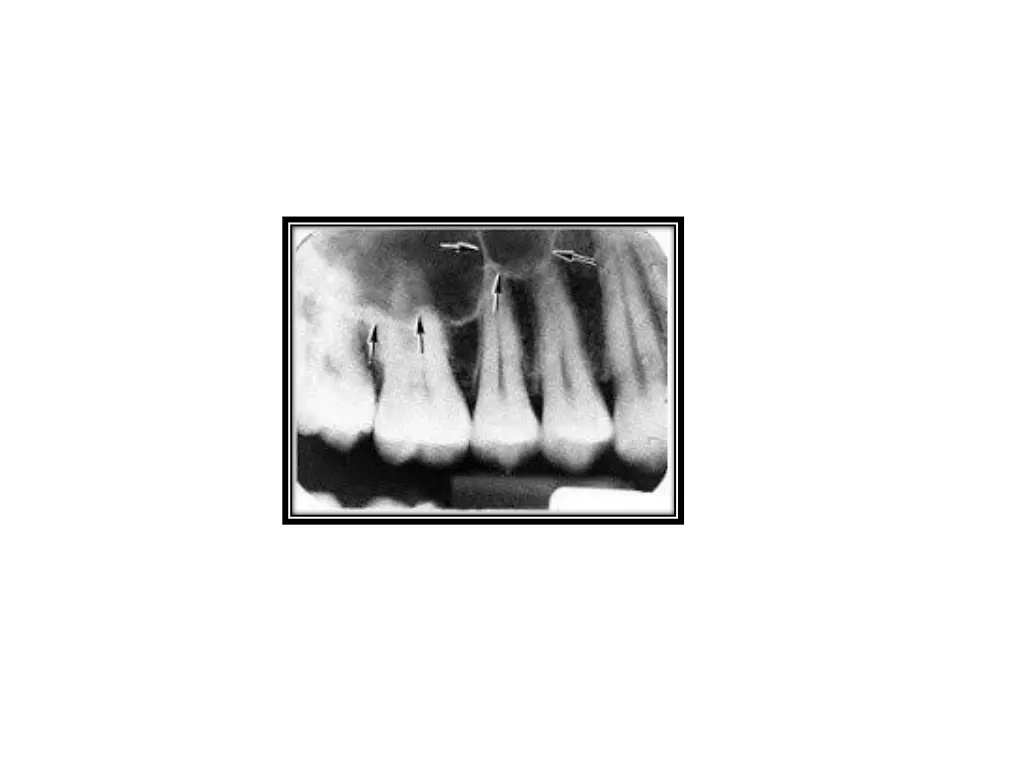 slide29