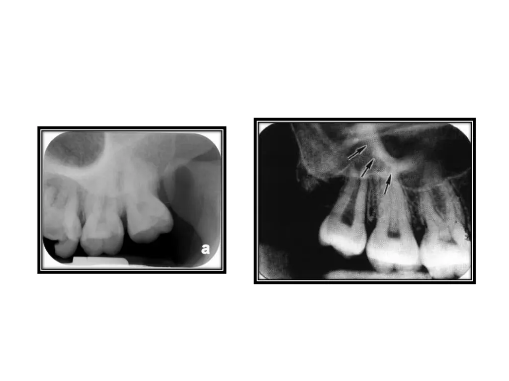 slide33