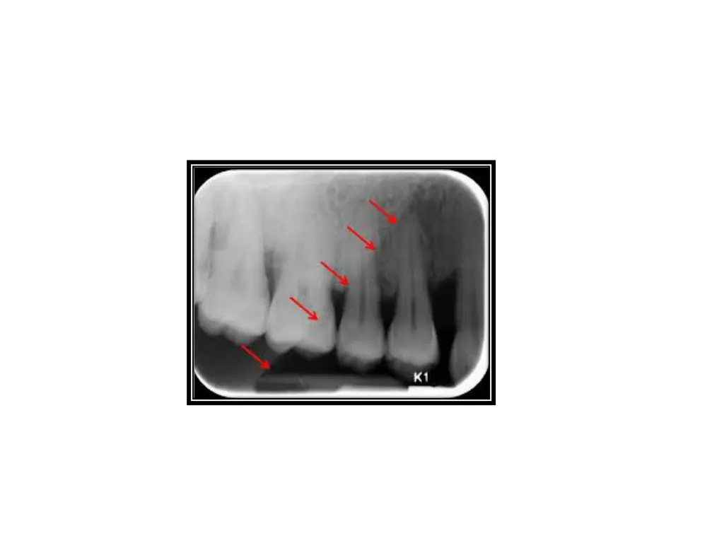 slide35