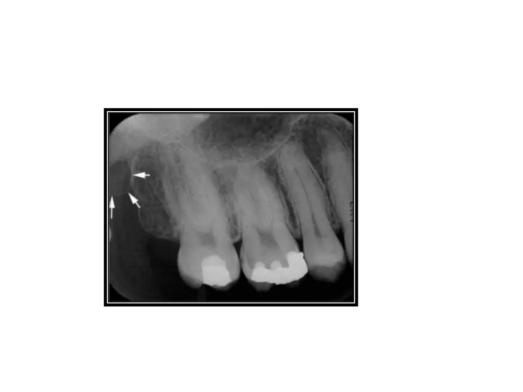slide37