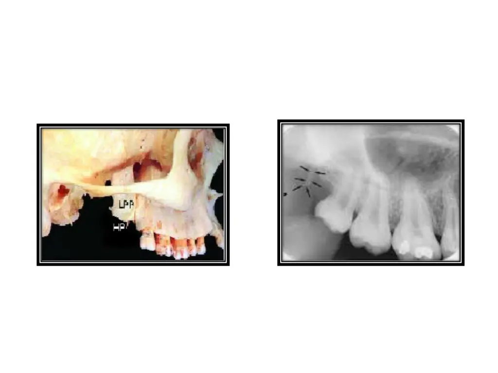 slide38