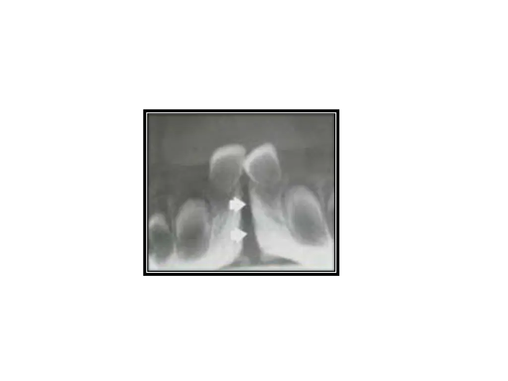 slide41