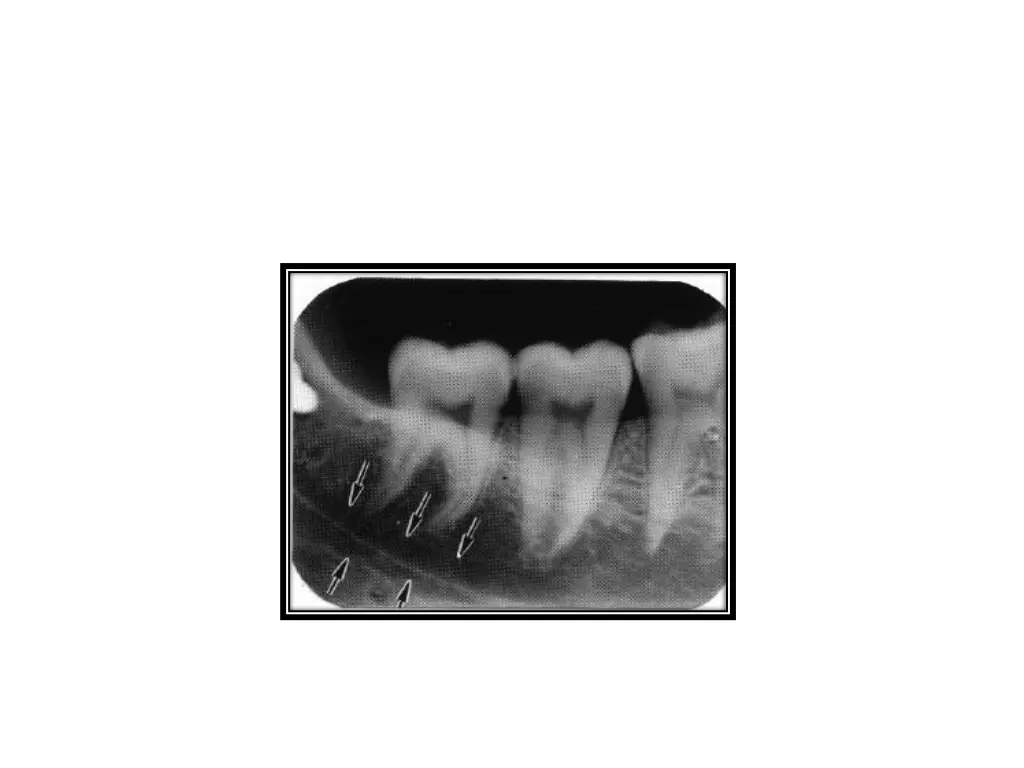 slide49