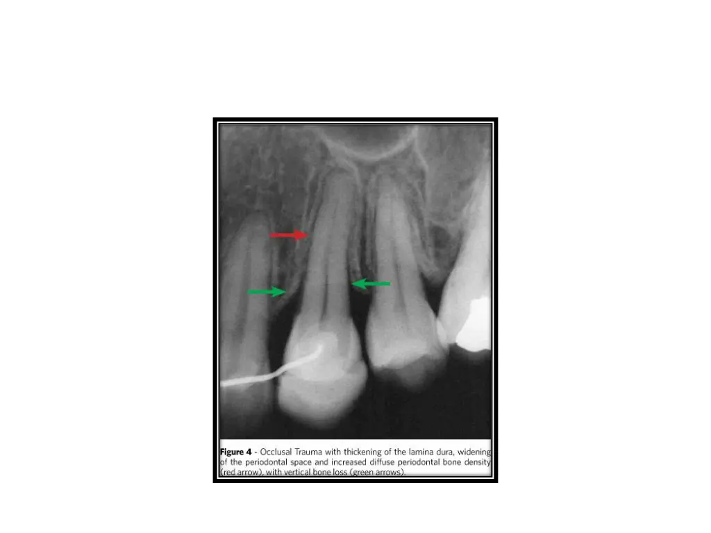 slide8