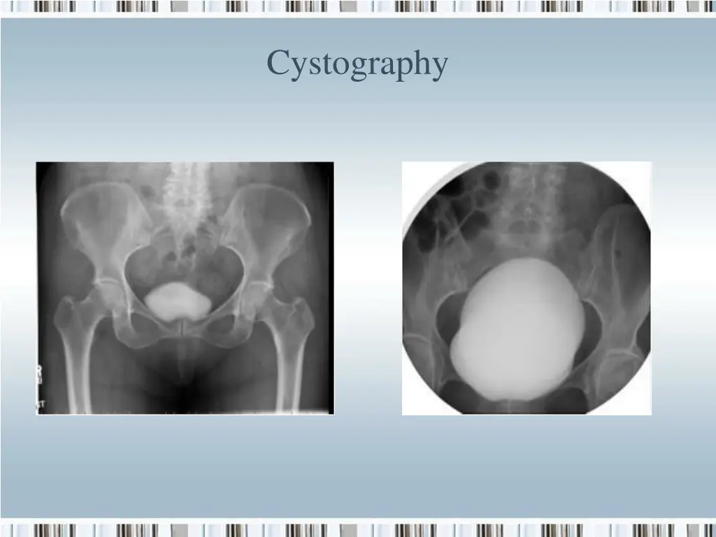cystography