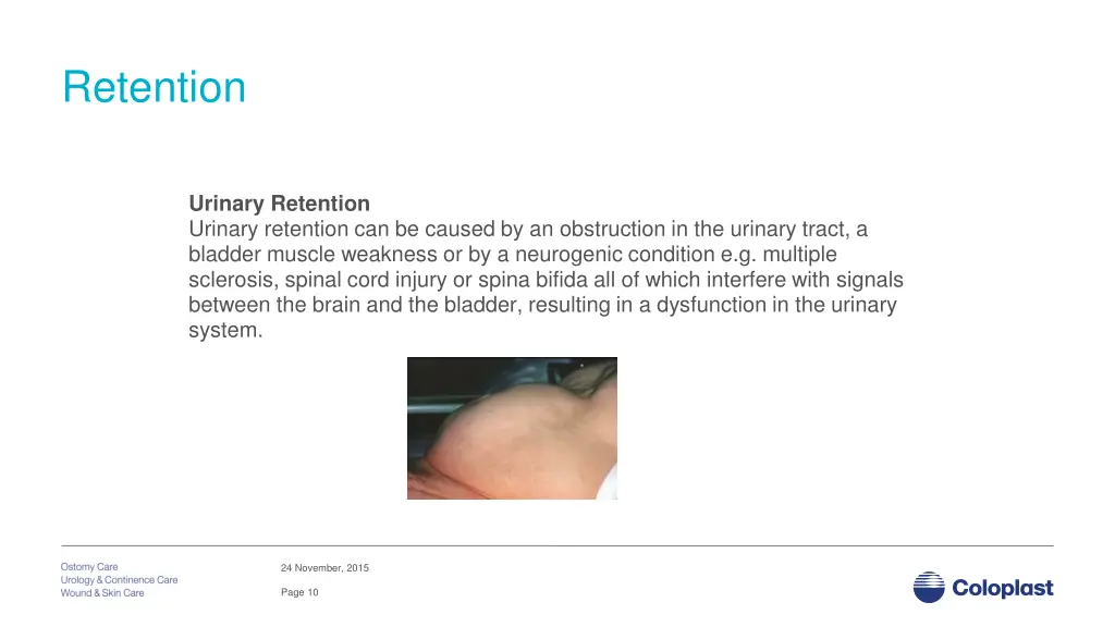 retention
