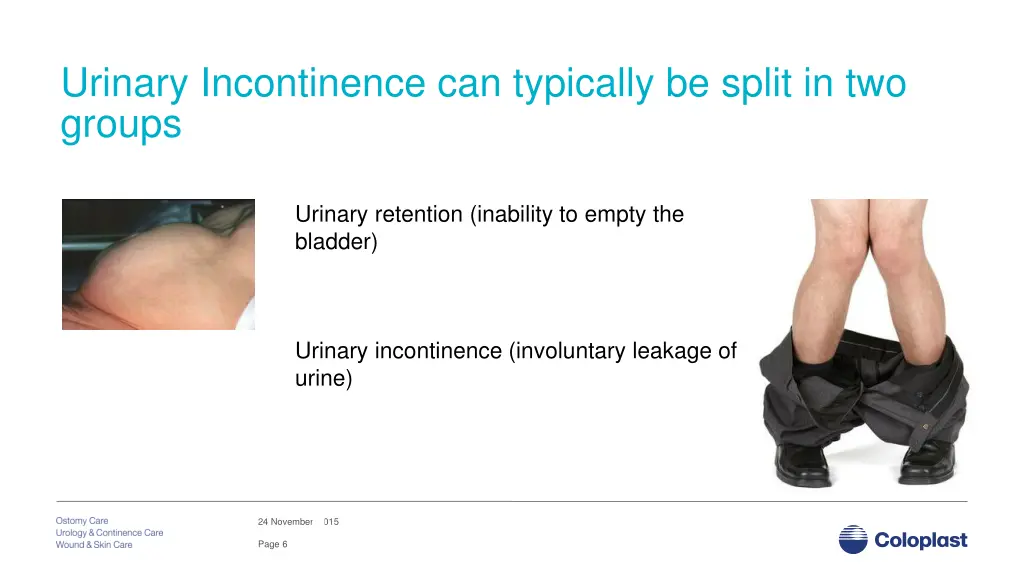 urinary incontinence can typically be split