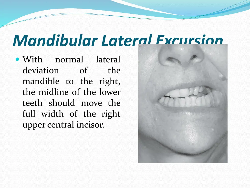 mandibular lateral excursion