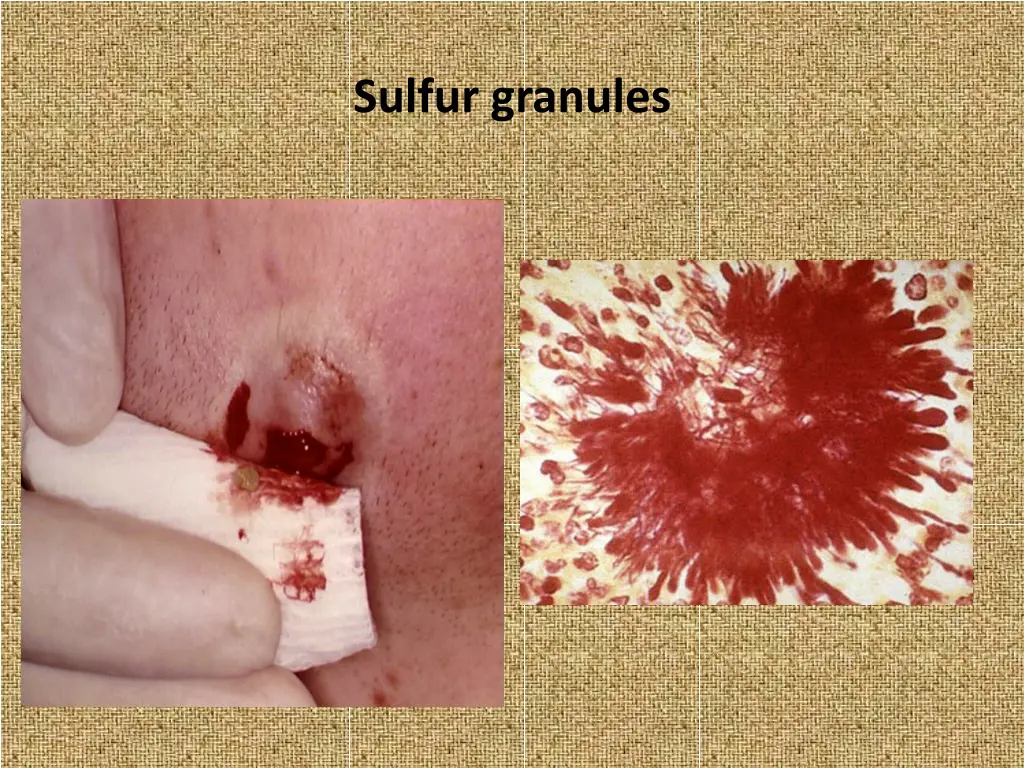 sulfur granules