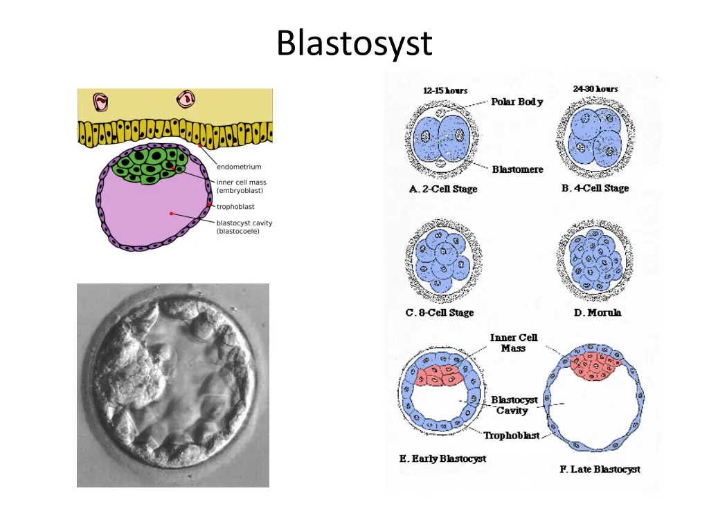 blastosyst