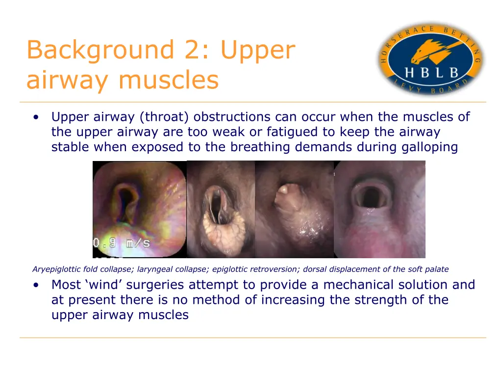 background 2 upper airway muscles
