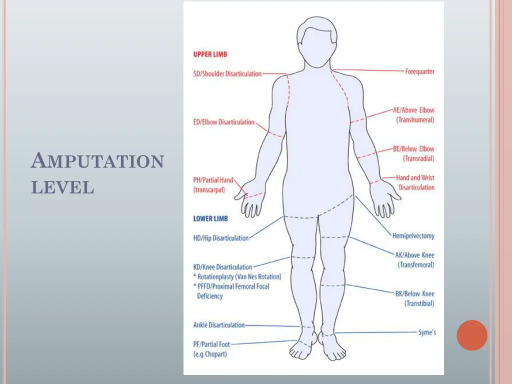 a mputation level