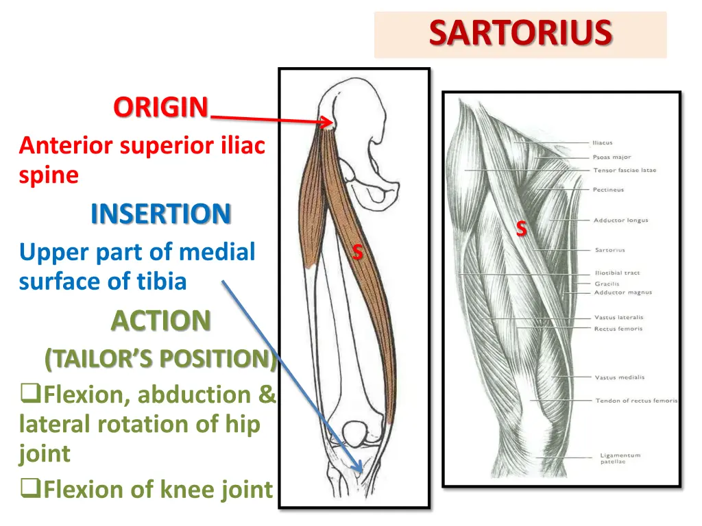 sartorius