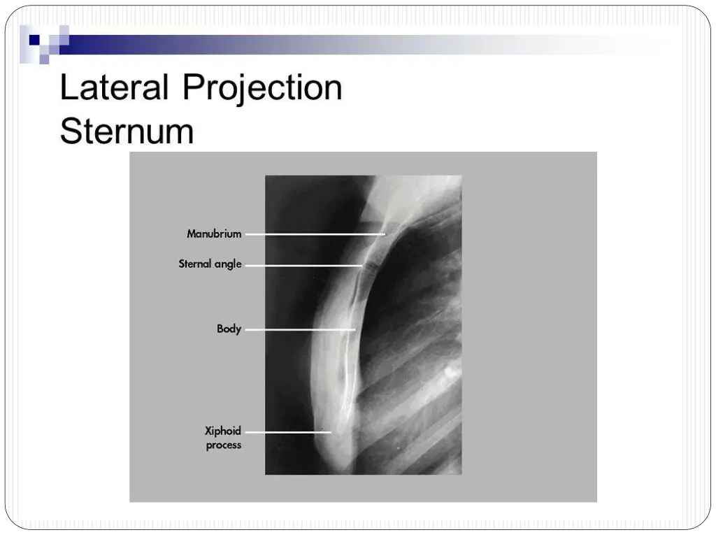slide8