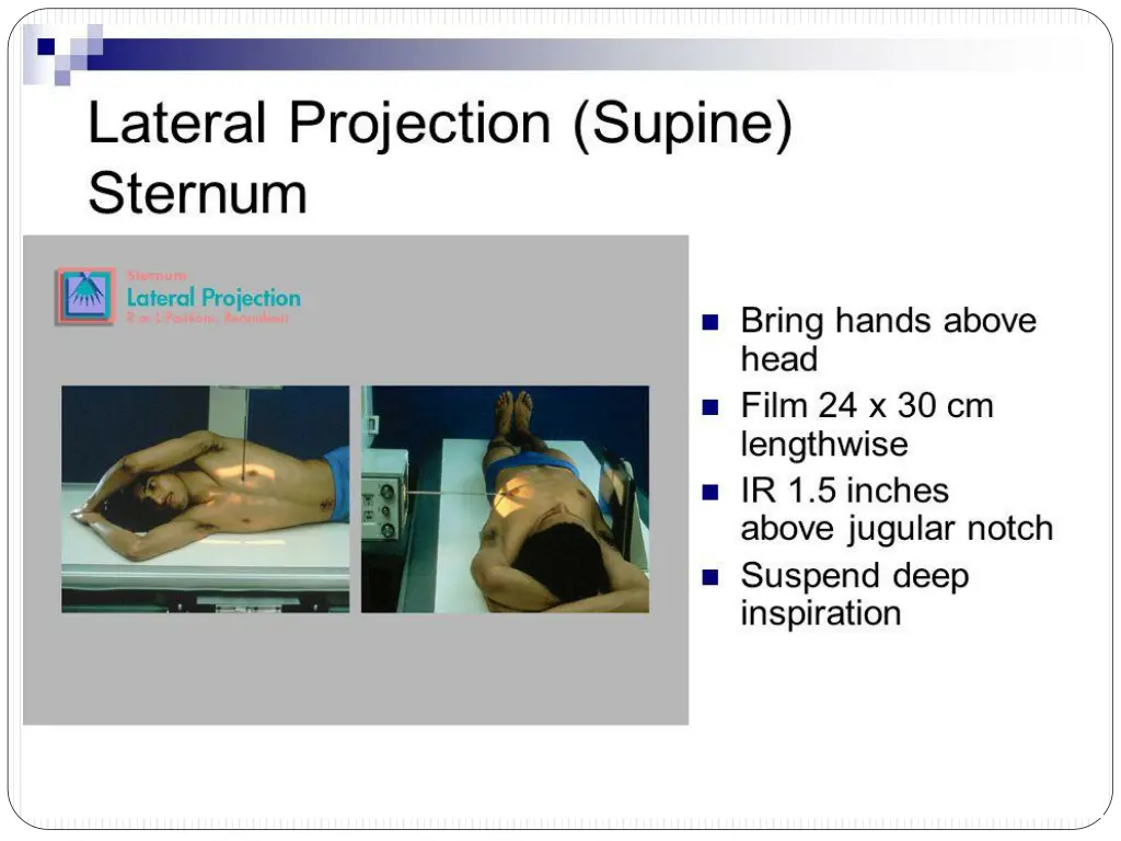 slide9