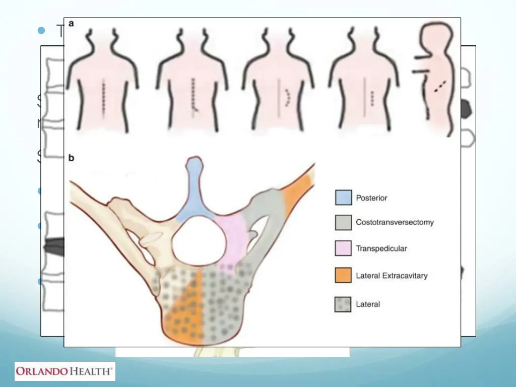 thoracic pathology surgical options