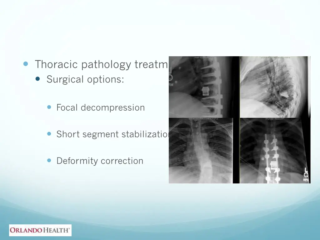 thoracic pathology treatment surgical options