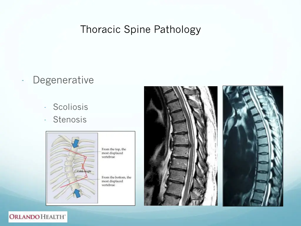 thoracic spine pathology 2