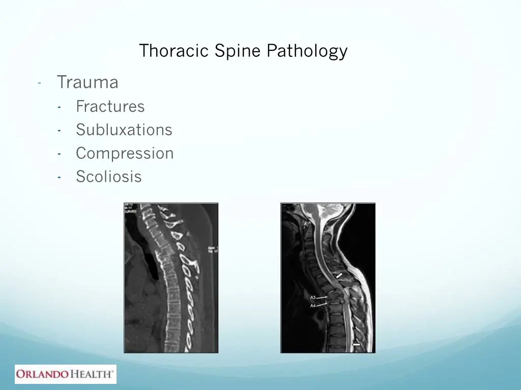 thoracic spine pathology 3