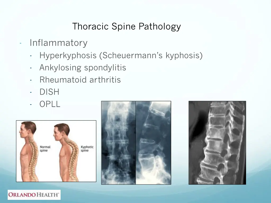 thoracic spine pathology inflammatory