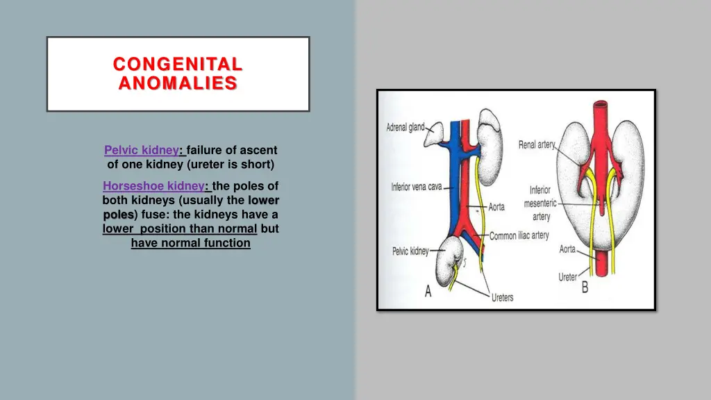 congenital anomalies