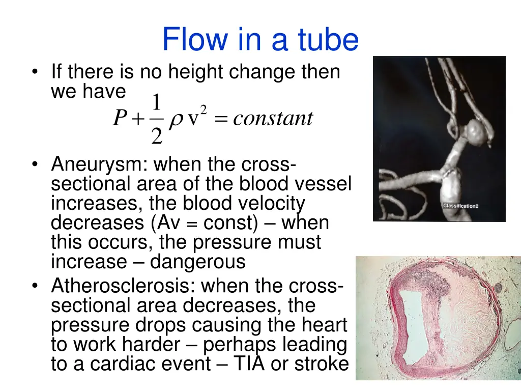 flow in a tube