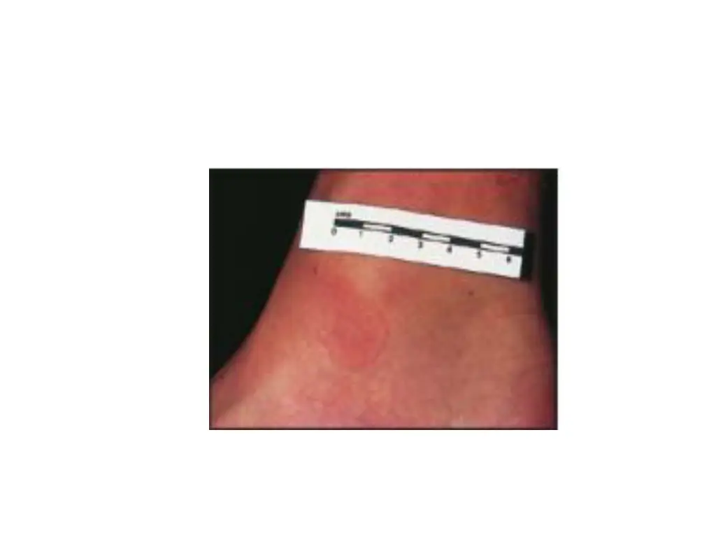 slide14