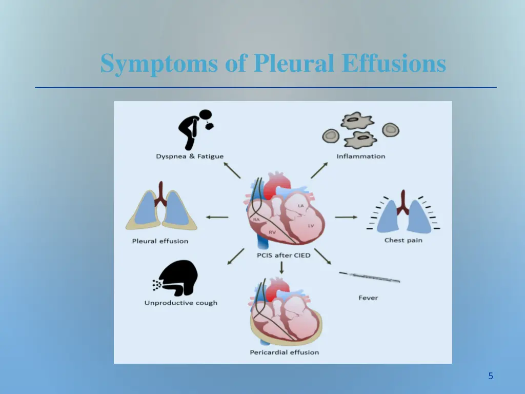 symptoms of pleural effusions