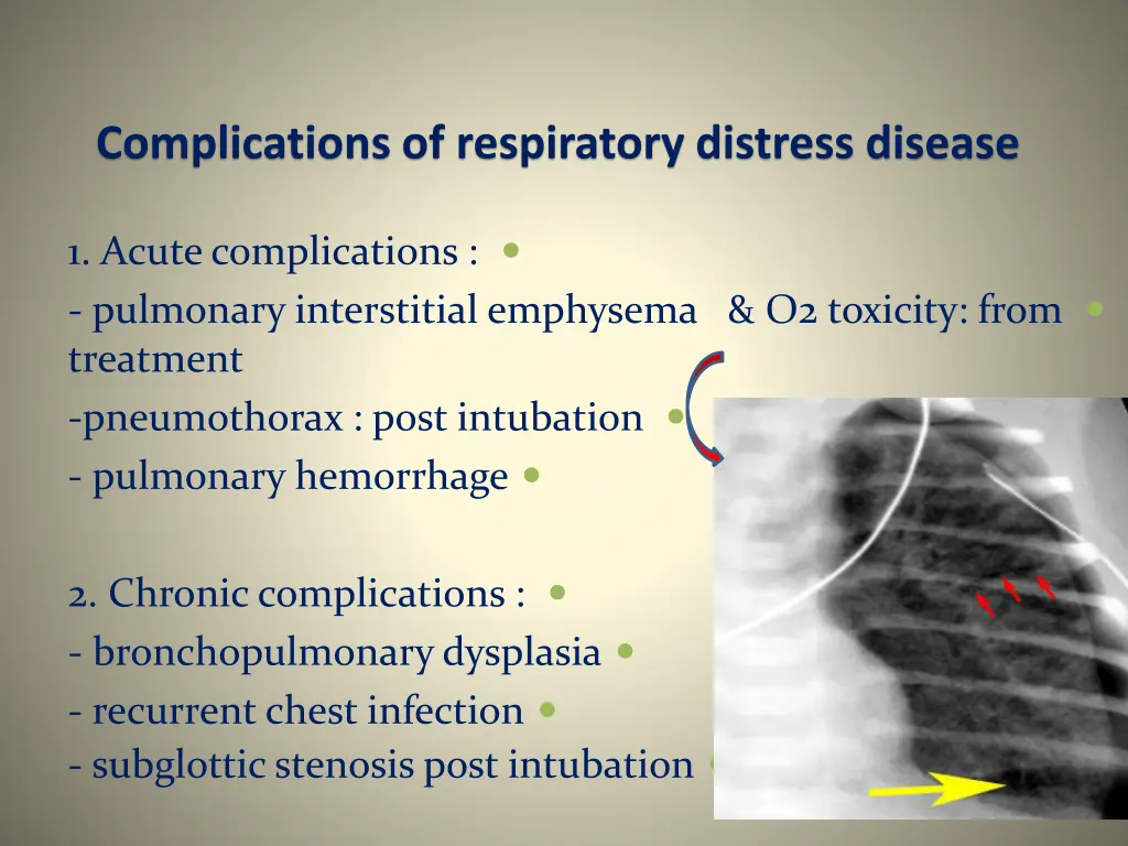 complications of respiratory distress disease