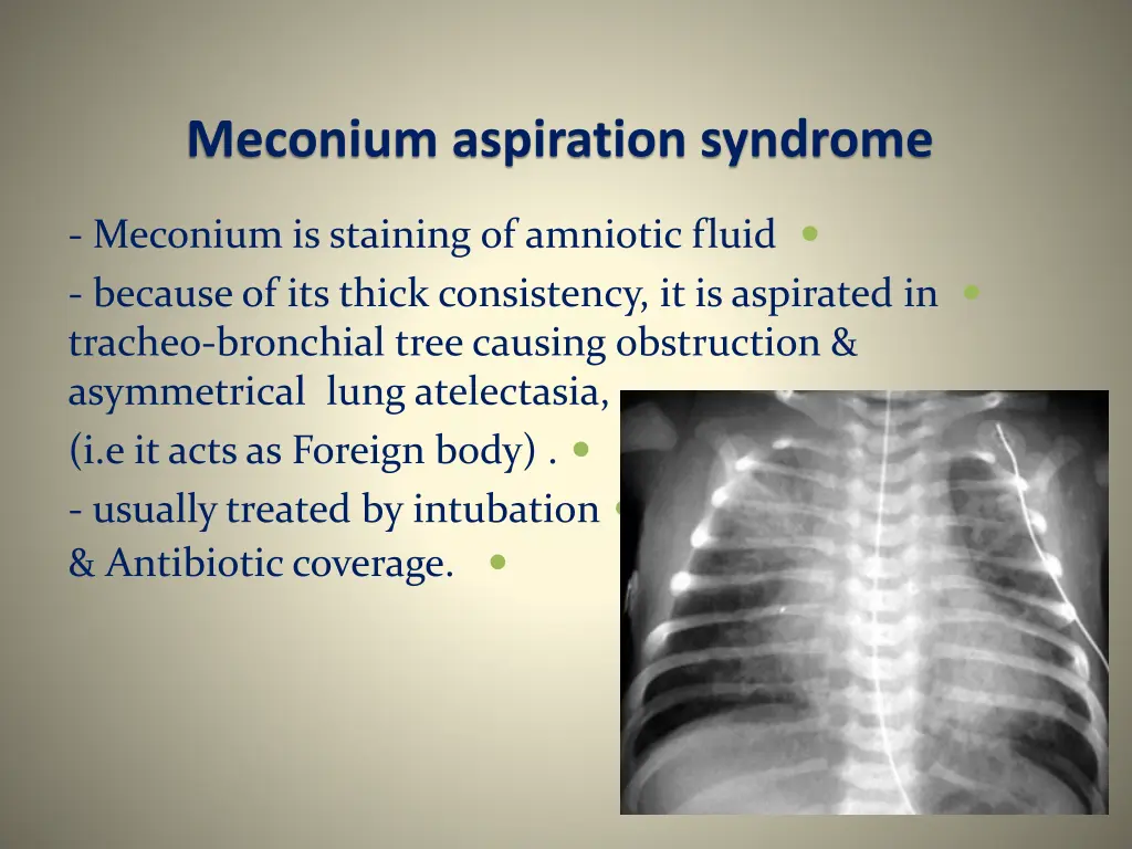 meconium aspiration syndrome